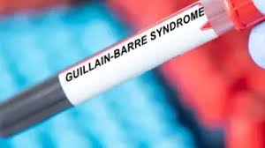 Mumbai Reports First Death Due to Guillain-Barré Syndrome, Maharashtra Toll Rises to 8